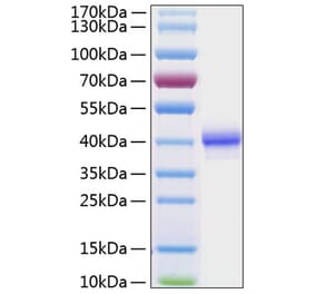 SDS-PAGE - Recombinant Human EGF Protein (C-terminal Human Fc and His Tag) (A330555) - Antibodies.com