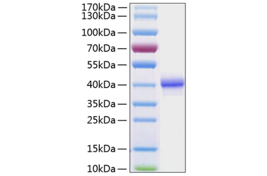 SDS-PAGE - Recombinant Human EGF Protein (C-terminal Human Fc and His Tag) (A330555) - Antibodies.com