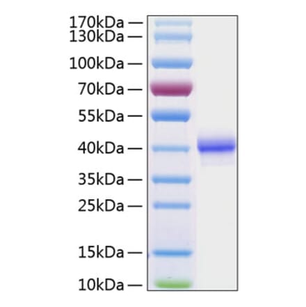SDS-PAGE - Recombinant Human EGF Protein (C-terminal Human Fc and His Tag) (A330555) - Antibodies.com