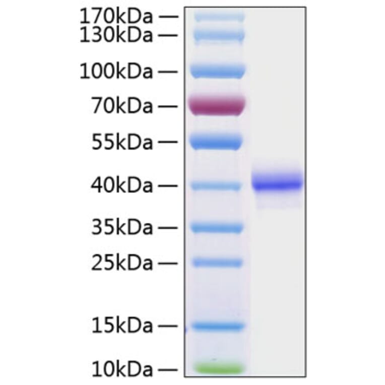 SDS-PAGE - Recombinant Human EGF Protein (C-terminal Human Fc and His Tag) (A330555) - Antibodies.com