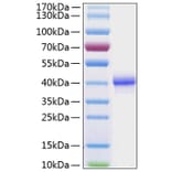 SDS-PAGE - Recombinant Human EGF Protein (C-terminal Human Fc and His Tag) (A330555) - Antibodies.com