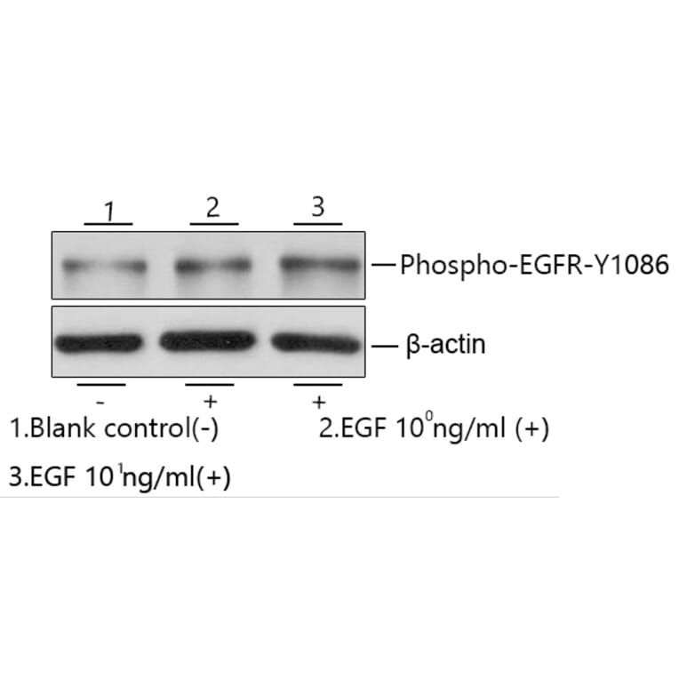 Western Blot - Recombinant Human EGF Protein (C-terminal Human Fc and His Tag) (A330555) - Antibodies.com