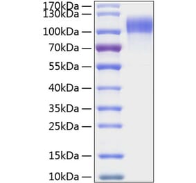 SDS-PAGE - Recombinant Human EGFR Protein (C-terminal His Tag) (A330556) - Antibodies.com