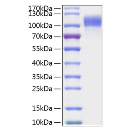 SDS-PAGE - Recombinant Human EGFR Protein (C-terminal His Tag) (A330556) - Antibodies.com