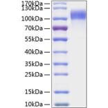 SDS-PAGE - Recombinant Human EGFR Protein (C-terminal His Tag) (A330556) - Antibodies.com