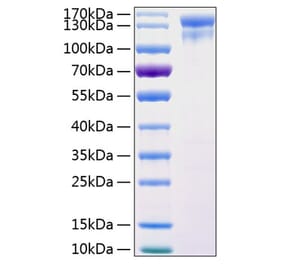 SDS-PAGE - Recombinant Human EGFR Protein (C-terminal Human Fc and His Tag) (A330557) - Antibodies.com