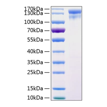 SDS-PAGE - Recombinant Human EGFR Protein (C-terminal Human Fc and His Tag) (A330557) - Antibodies.com