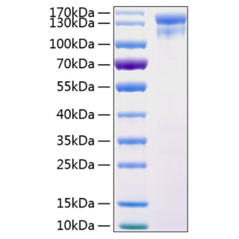 SDS-PAGE - Recombinant Human EGFR Protein (C-terminal Human Fc and His Tag) (A330557) - Antibodies.com