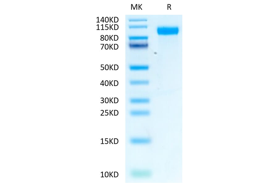 Tris-Bis PAGE - Recombinant Human EGFR Protein (Biotin) (C-terminal His and Avi Tag) (A330558) - Antibodies.com