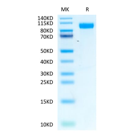 Tris-Bis PAGE - Recombinant Human EGFR Protein (Biotin) (C-terminal His and Avi Tag) (A330558) - Antibodies.com
