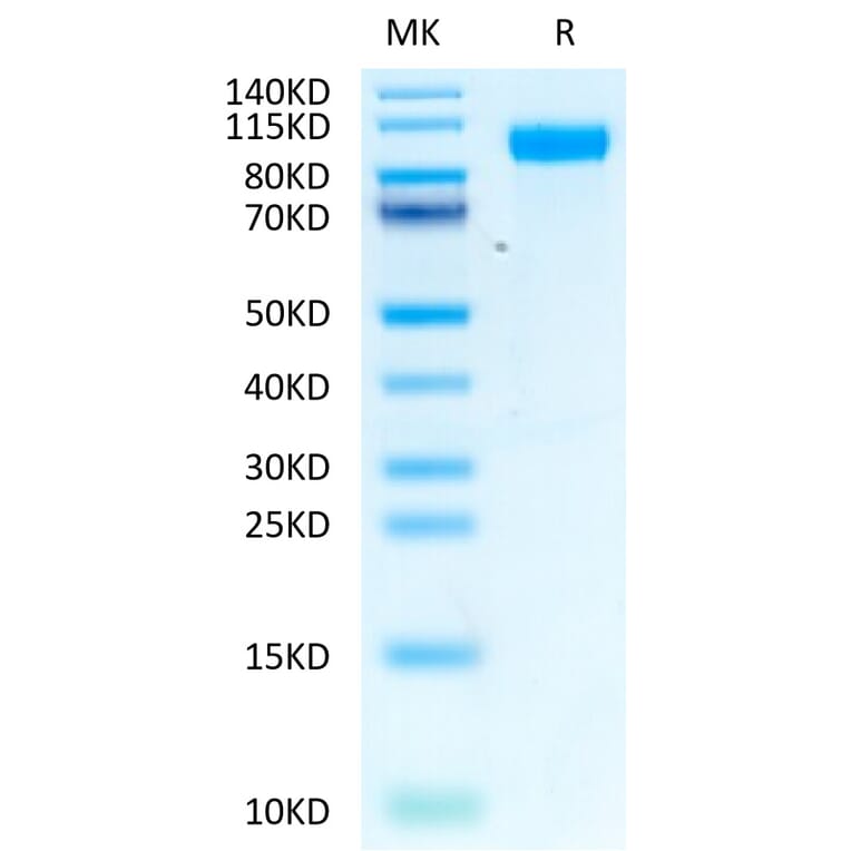 Tris-Bis PAGE - Recombinant Human EGFR Protein (Biotin) (C-terminal His and Avi Tag) (A330558) - Antibodies.com