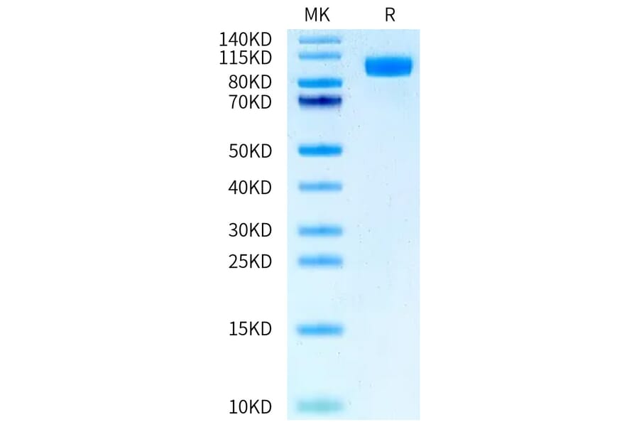 Tris-Bis PAGE - Recombinant Human EGFR Protein (FITC) (C-terminal His and Avi Tag) (A330559) - Antibodies.com