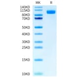 Tris-Bis PAGE - Recombinant Human EGFR Protein (FITC) (C-terminal His and Avi Tag) (A330559) - Antibodies.com
