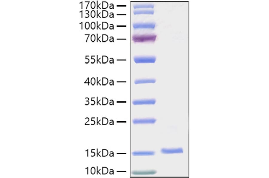 SDS-PAGE - Recombinant Human EG-VEGF Protein (C-terminal His Tag) (A330560) - Antibodies.com