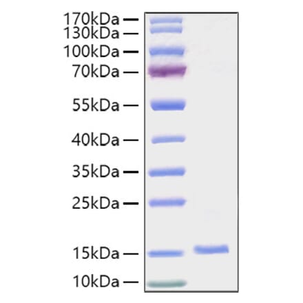 SDS-PAGE - Recombinant Human EG-VEGF Protein (C-terminal His Tag) (A330560) - Antibodies.com