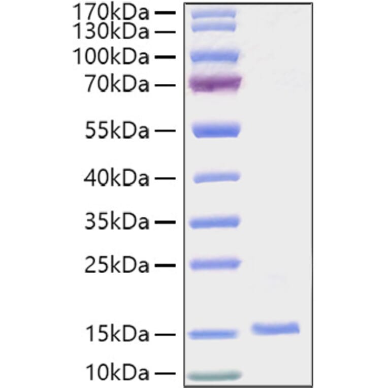 SDS-PAGE - Recombinant Human EG-VEGF Protein (C-terminal His Tag) (A330560) - Antibodies.com