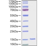 SDS-PAGE - Recombinant Human EG-VEGF Protein (C-terminal His Tag) (A330560) - Antibodies.com