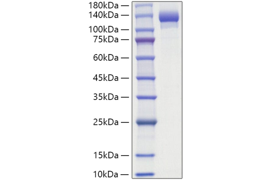 SDS-PAGE - Recombinant Human ENPP1 Protein (C-terminal His Tag) (A330561) - Antibodies.com