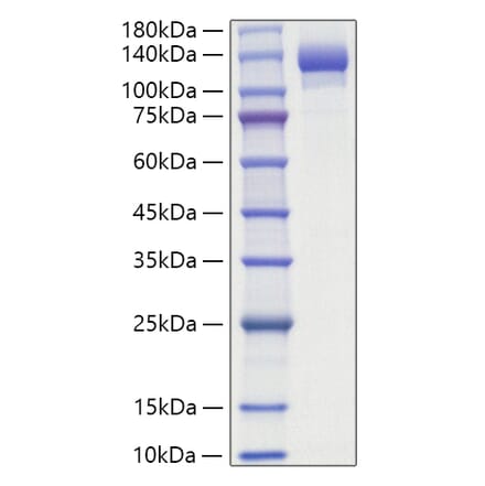 SDS-PAGE - Recombinant Human ENPP1 Protein (C-terminal His Tag) (A330561) - Antibodies.com