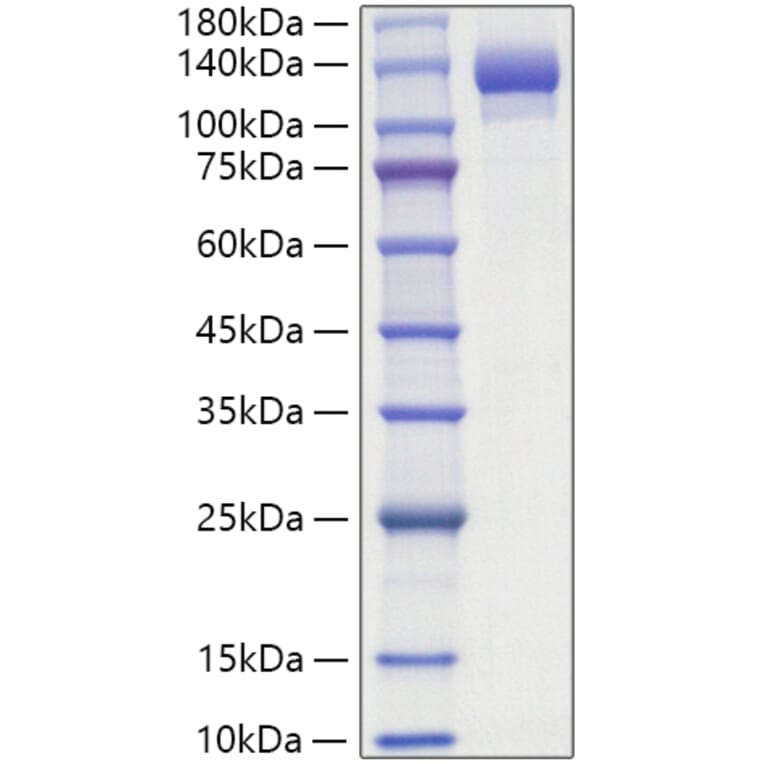 SDS-PAGE - Recombinant Human ENPP1 Protein (C-terminal His Tag) (A330561) - Antibodies.com