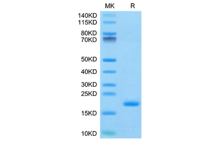 Tris-Bis PAGE - Recombinant Human ENPP3 Protein (N-terminal His and Avi Tag) (A330563) - Antibodies.com