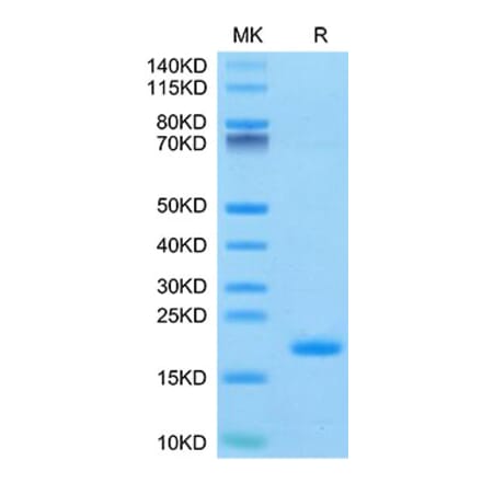 Tris-Bis PAGE - Recombinant Human ENPP3 Protein (N-terminal His and Avi Tag) (A330563) - Antibodies.com