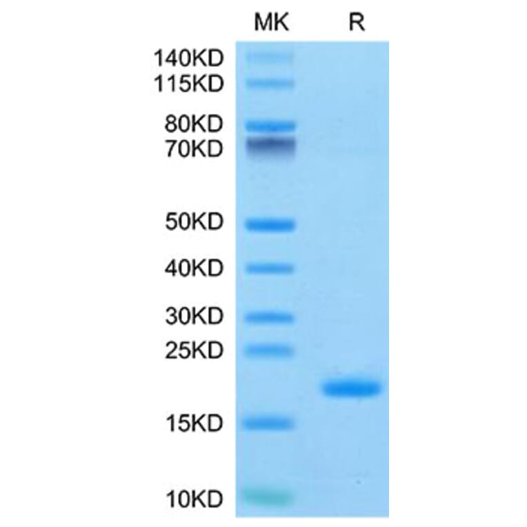 Tris-Bis PAGE - Recombinant Human ENPP3 Protein (N-terminal His and Avi Tag) (A330563) - Antibodies.com