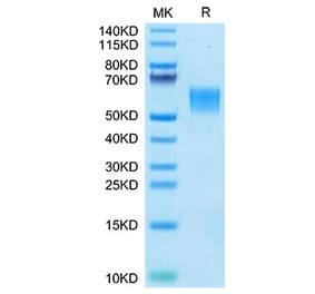 Tris-Bis PAGE - Recombinant Human ENPP3 Protein (N-terminal His Tag) (A330564) - Antibodies.com