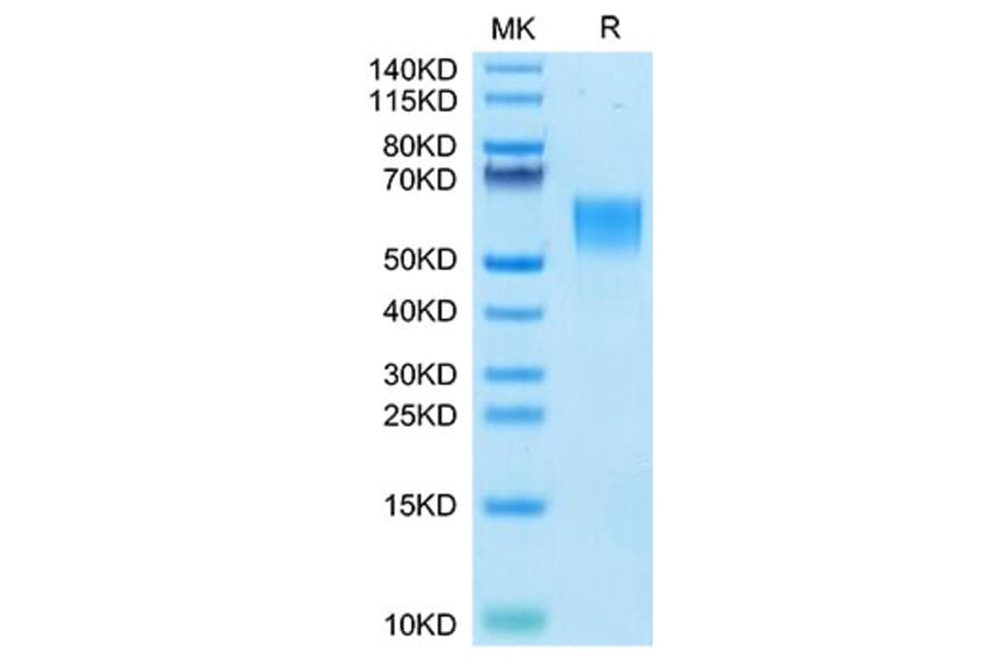 Tris-Bis PAGE - Recombinant Human ENPP3 Protein (N-terminal His Tag) (A330564) - Antibodies.com