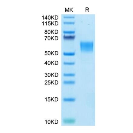 Tris-Bis PAGE - Recombinant Human ENPP3 Protein (N-terminal His Tag) (A330564) - Antibodies.com