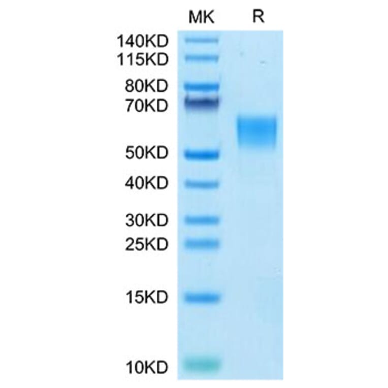 Tris-Bis PAGE - Recombinant Human ENPP3 Protein (N-terminal His Tag) (A330564) - Antibodies.com