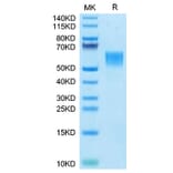 Tris-Bis PAGE - Recombinant Human ENPP3 Protein (N-terminal His Tag) (A330564) - Antibodies.com
