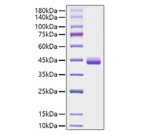 SDS-PAGE - Recombinant Human Eotaxin Protein (C-terminal Human Fc Tag) (A330565) - Antibodies.com