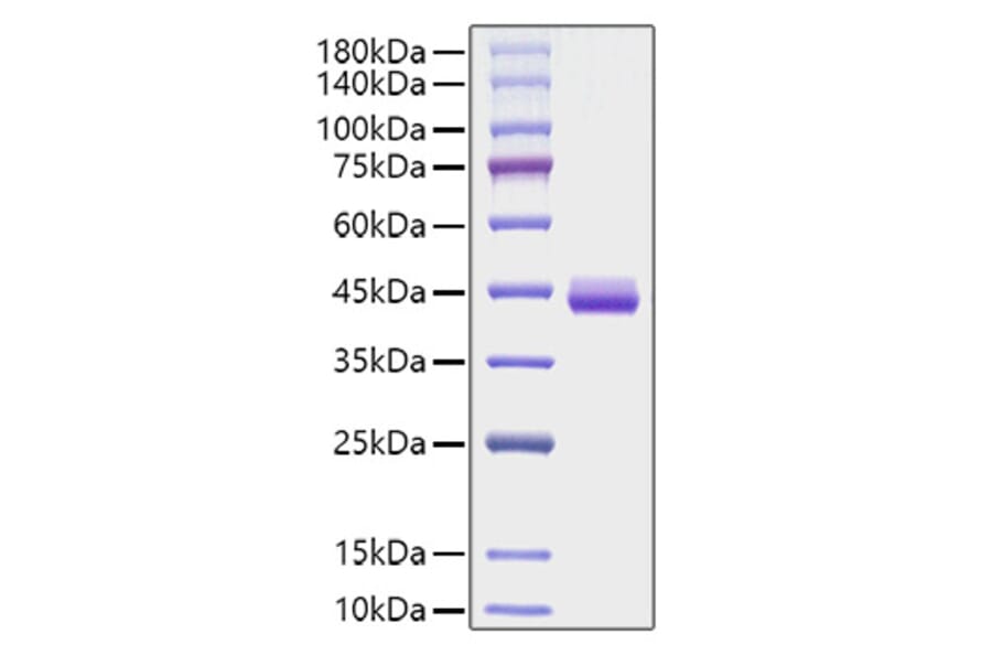 SDS-PAGE - Recombinant Human Eotaxin Protein (C-terminal Human Fc Tag) (A330565) - Antibodies.com