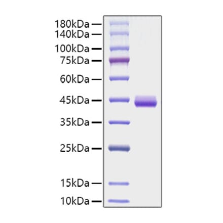 SDS-PAGE - Recombinant Human Eotaxin Protein (C-terminal Human Fc Tag) (A330565) - Antibodies.com