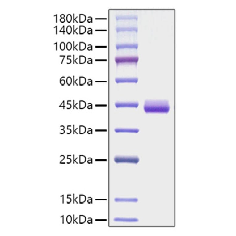 SDS-PAGE - Recombinant Human Eotaxin Protein (C-terminal Human Fc Tag) (A330565) - Antibodies.com