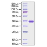 SDS-PAGE - Recombinant Human Eotaxin Protein (C-terminal Human Fc Tag) (A330565) - Antibodies.com