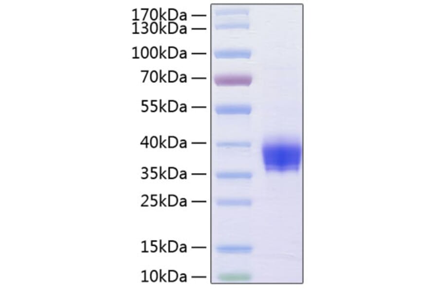 SDS-PAGE - Recombinant Human EpCAM Protein (C-terminal His Tag) (A330567) - Antibodies.com