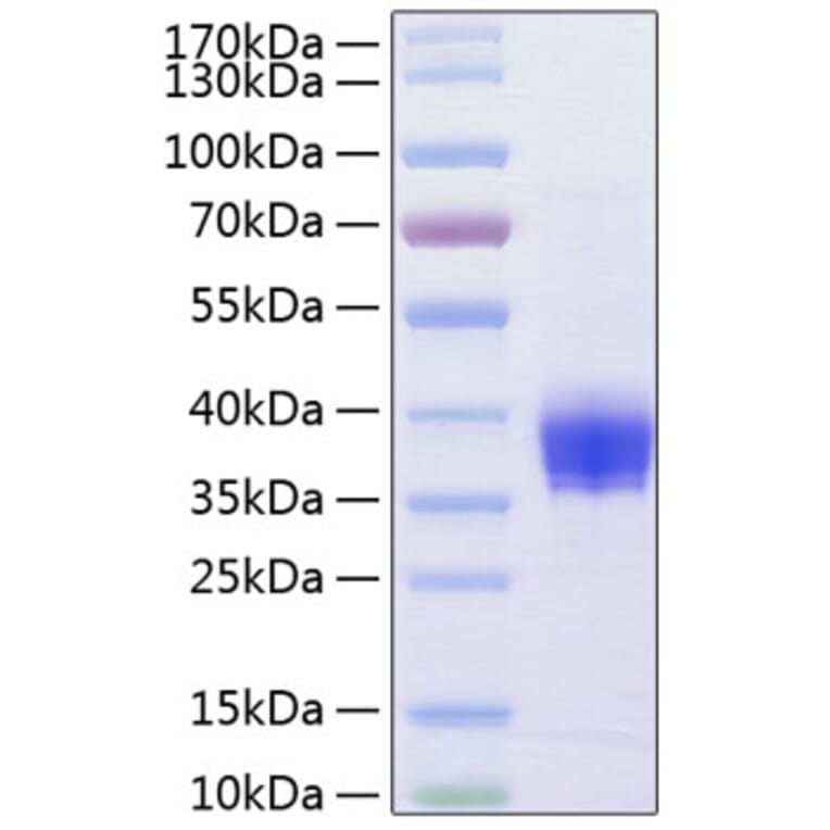 SDS-PAGE - Recombinant Human EpCAM Protein (C-terminal His Tag) (A330567) - Antibodies.com