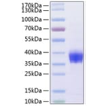 SDS-PAGE - Recombinant Human EpCAM Protein (C-terminal His Tag) (A330567) - Antibodies.com