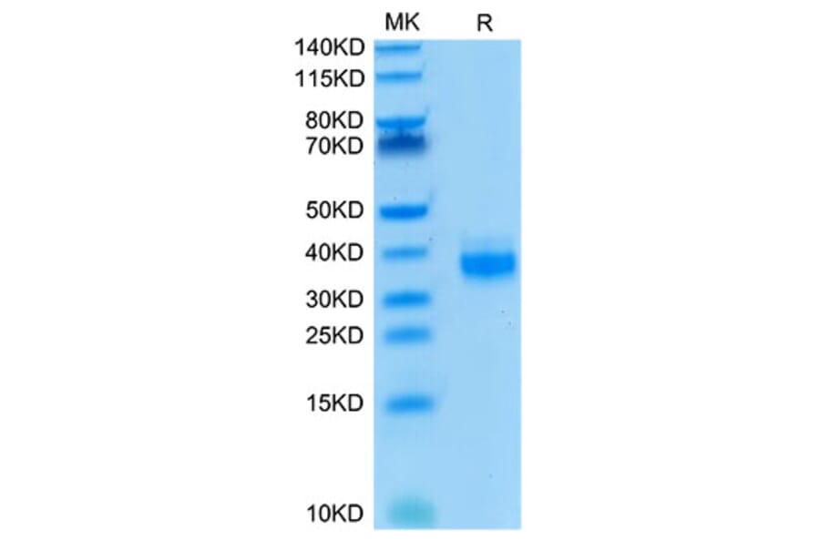 Tris-Bis PAGE - Recombinant Human EpCAM Protein (Biotin) (C-terminal His and Avi Tag) (A330568) - Antibodies.com