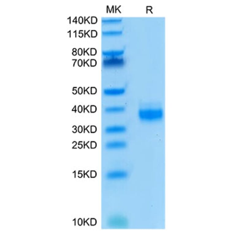 Tris-Bis PAGE - Recombinant Human EpCAM Protein (Biotin) (C-terminal His and Avi Tag) (A330568) - Antibodies.com