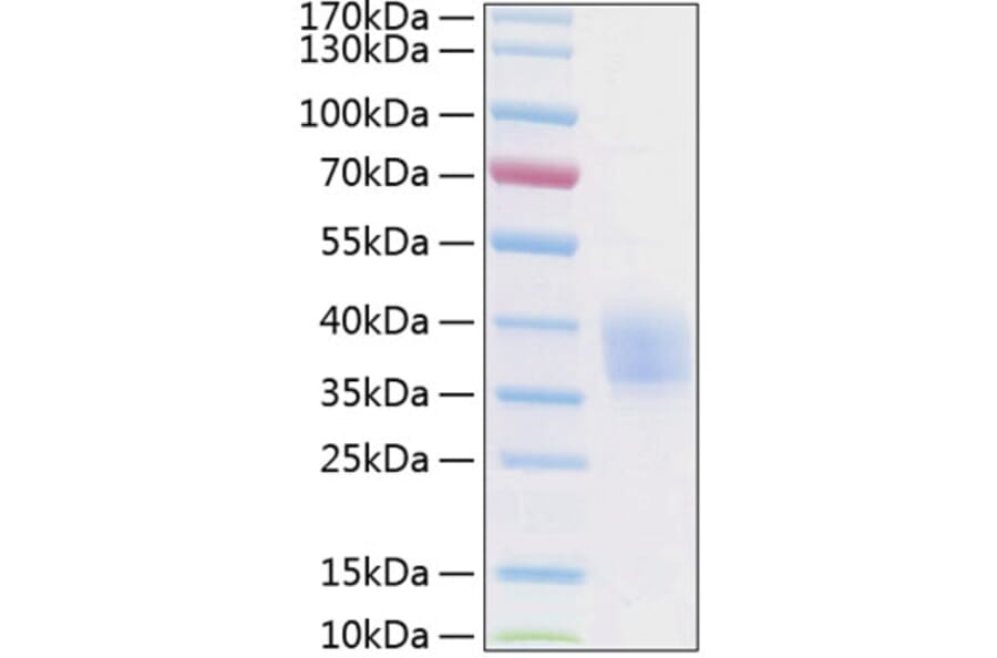 SDS-PAGE - Recombinant Human EPCR Protein (C-terminal His Tag) (A330569) - Antibodies.com