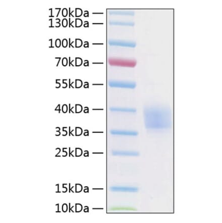 SDS-PAGE - Recombinant Human EPCR Protein (C-terminal His Tag) (A330569) - Antibodies.com