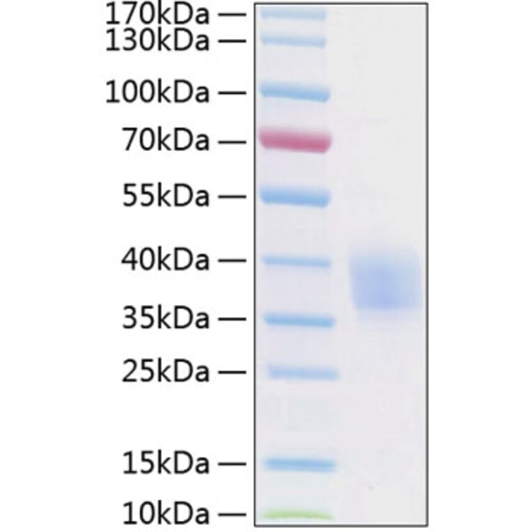 SDS-PAGE - Recombinant Human EPCR Protein (C-terminal His Tag) (A330569) - Antibodies.com