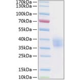 SDS-PAGE - Recombinant Human EPCR Protein (C-terminal His Tag) (A330569) - Antibodies.com