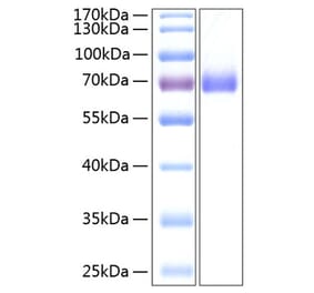 SDS-PAGE - Recombinant Human EPHA2 Protein (C-terminal His Tag) (A330570) - Antibodies.com