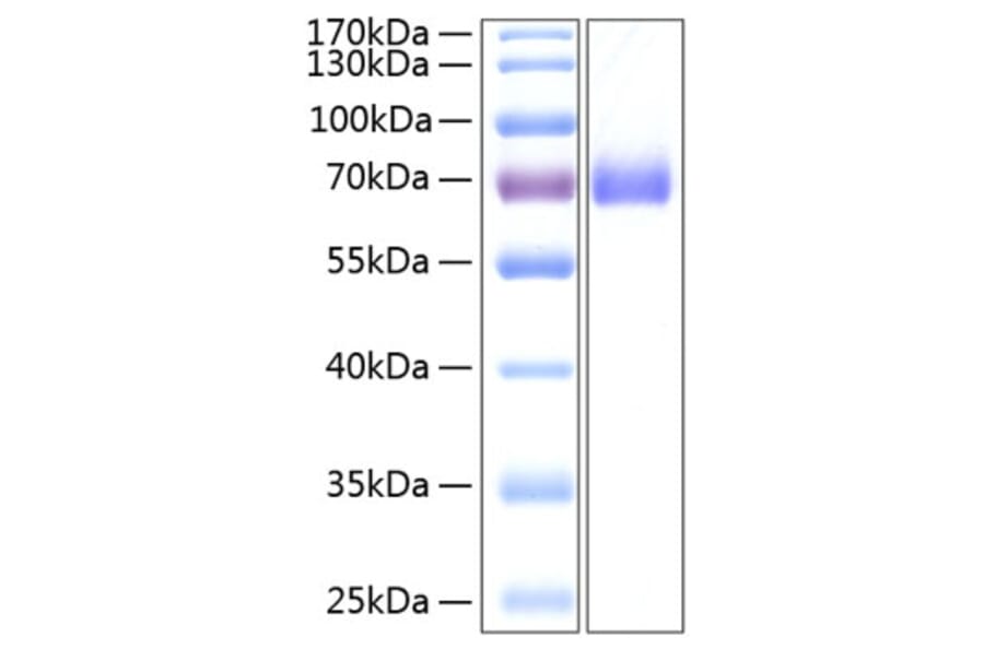 SDS-PAGE - Recombinant Human EPHA2 Protein (C-terminal His Tag) (A330570) - Antibodies.com