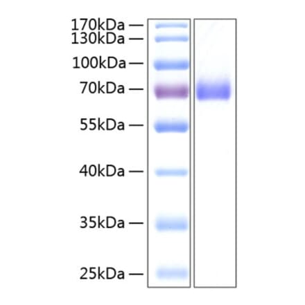 SDS-PAGE - Recombinant Human EPHA2 Protein (C-terminal His Tag) (A330570) - Antibodies.com