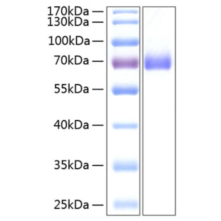 SDS-PAGE - Recombinant Human EPHA2 Protein (C-terminal His Tag) (A330570) - Antibodies.com